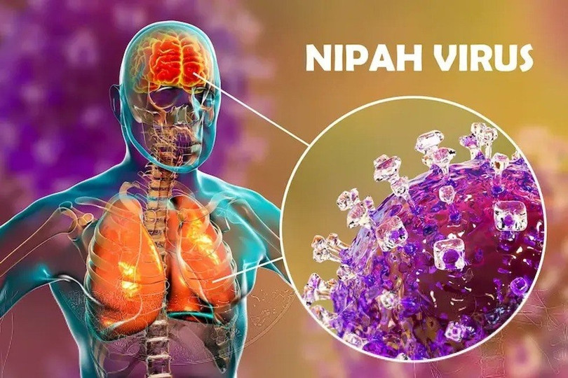 Virus nipah là gì