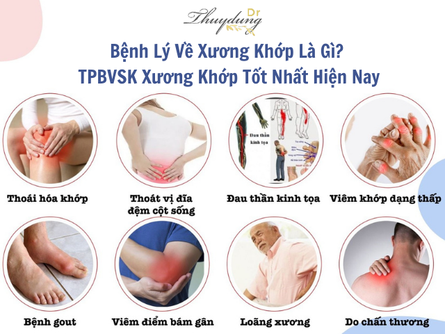 TPBVSK Xương Khớp Tốt Nhất Hiện Nay