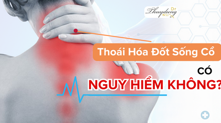 Thoái Hóa Đốt Sống Cổ Có Nguy Hiểm Không?