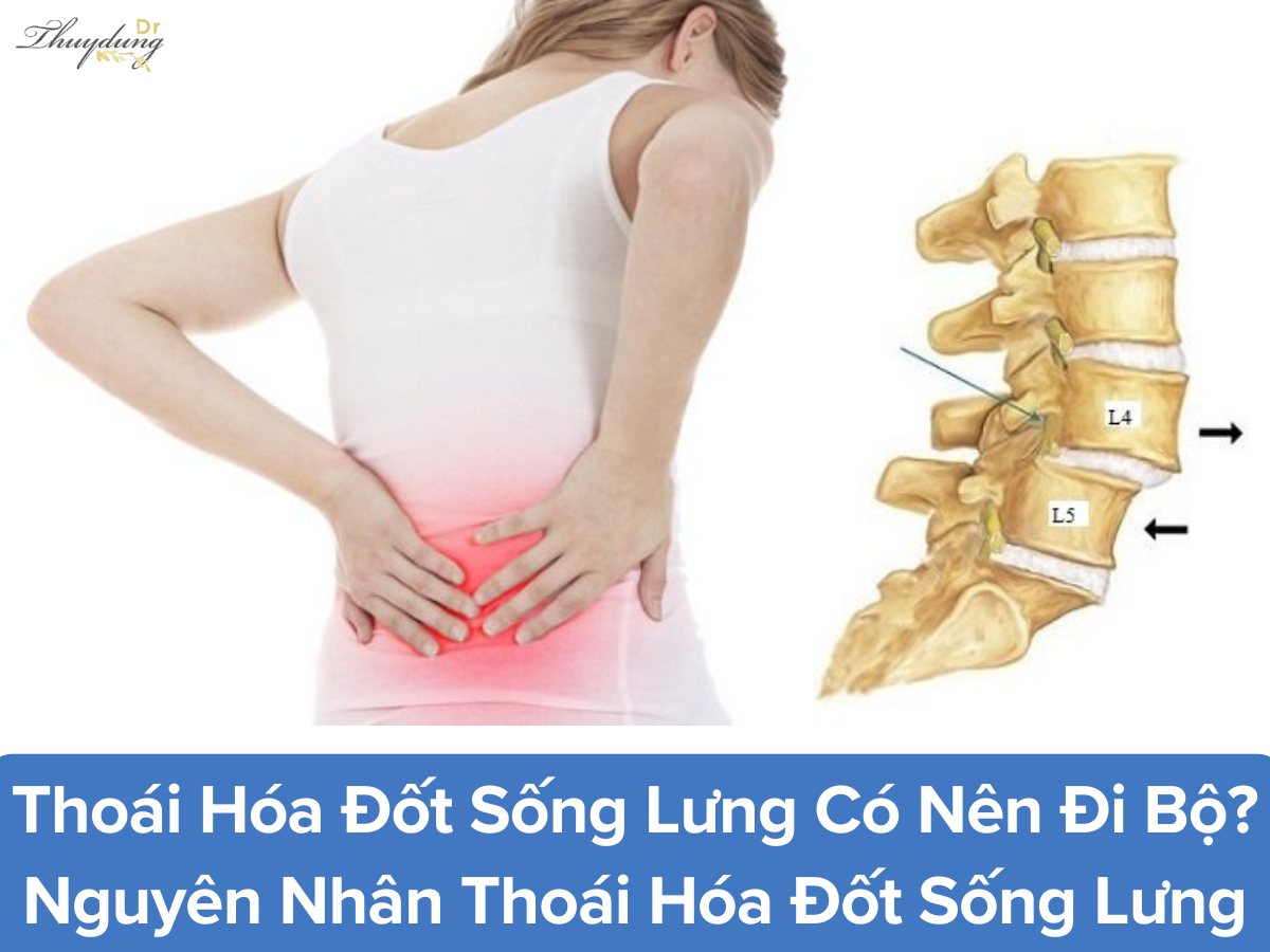 Thoái Hóa Đốt Sống Lưng Có Nên Đi Bộ?