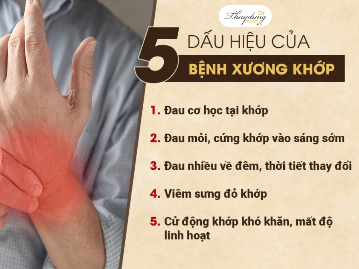 Đau Nhức Xương Khớp Uống Thuốc gì?