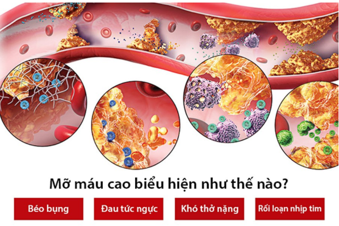 Mỡ Máu Nguy Hiểm Như Thế Nào