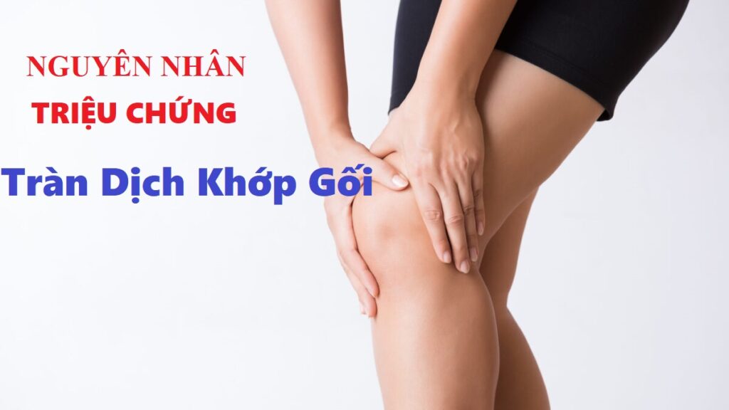 Tràn Dịch Khớp Gối