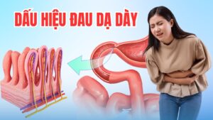 Dấu hiệu đau dạ dày