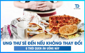 Ung Thư Sẽ Đến Nếu Không Thay Đổi 6 Thói Quen Ăn Uống Này