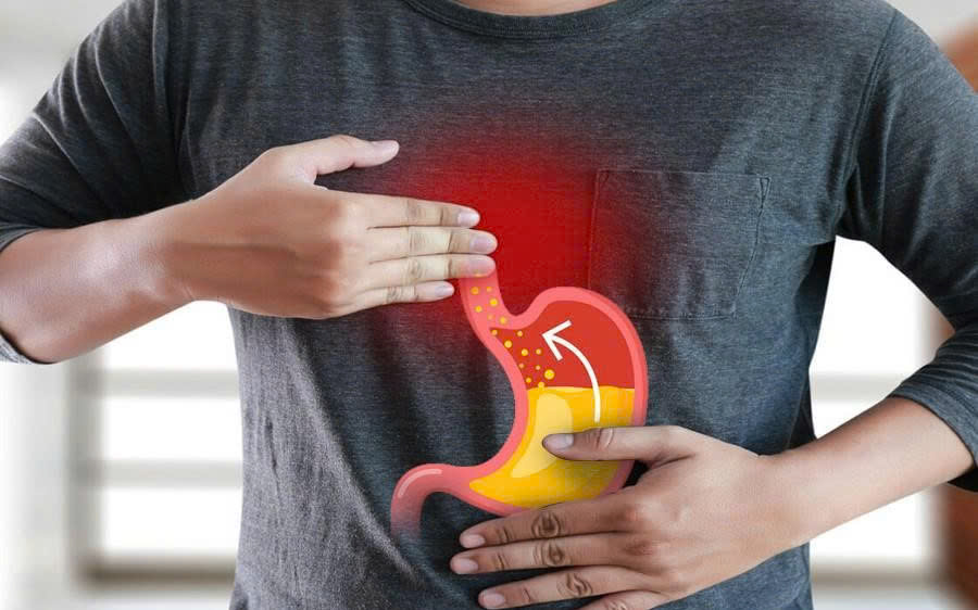 Ascugin Nano Curcumin là “trợ thủ” đắc lực trong việc đẩy lùi viêm dạ dày cấp