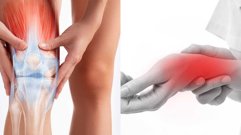 Các cơn đau nhức ảnh hưởng tới quá trình vận động hàng ngày