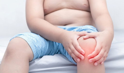 Trọng lượng cơ thể quá mức tạo áp lực lớn và liên tục lên khớp gối
